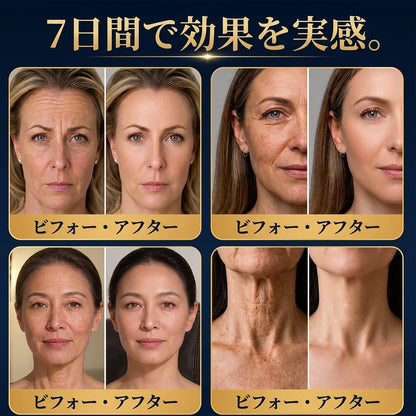 🔥🎄Solaroza® 360° アイスクールローラー — わずか7日間で、目の下のくま・むくみ・小じわを目に見えて軽減。マトリキシル3000、ニューロペプチド、カフェインを配合。