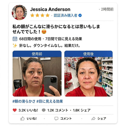 🔥🎄Solaroza® 360° アイスクールローラー — わずか7日間で、目の下のくま・むくみ・小じわを目に見えて軽減。マトリキシル3000、ニューロペプチド、カフェインを配合。